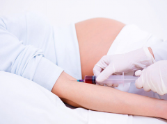 怀孕多久做唐筛，孕期唐筛的重要性及操作方法