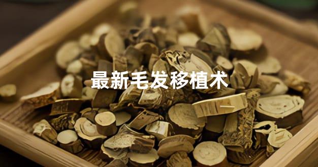 最新毛发移植术