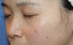 <b>女人长斑的位置图解，这些改善方法，学起来</b>